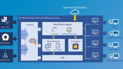 philips intellispace ai workflow suite (öffnet sich in einem neuen Fenster)