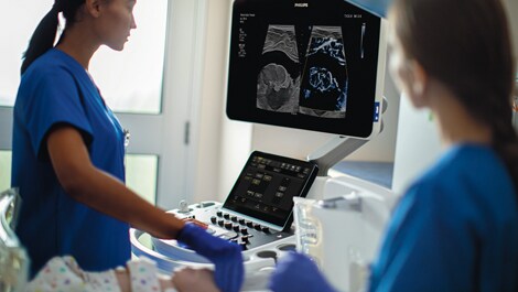 philips epiq elite paediatrie (öffnet sich in einem neuen Fenster)
