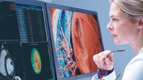 RSNA 2020: Philips stellt nächste Generation der Visualisierungslösung IntelliSpace Portal vor 