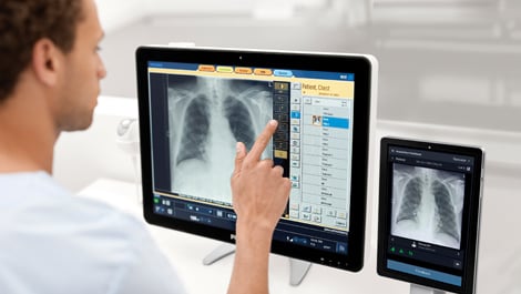 Philips Radiology Smart Assistant (öffnet sich in einem neuen Fenster)