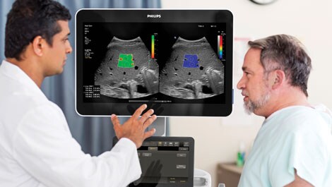 Philips RSNA Ultraschall Leberfettquantifizierung