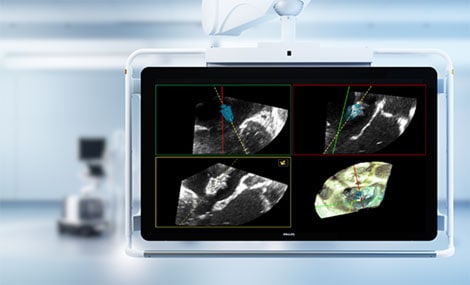 DeviceGuide Zielmodus