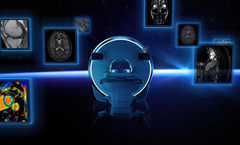 Philips Horizon: Technologischer Durchbruch mit erstem heliumfreien 3.0T MRT 