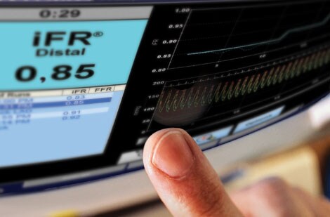 Philips Volcano IFR Screen Image (öffnet sich in einem neuen Fenster)