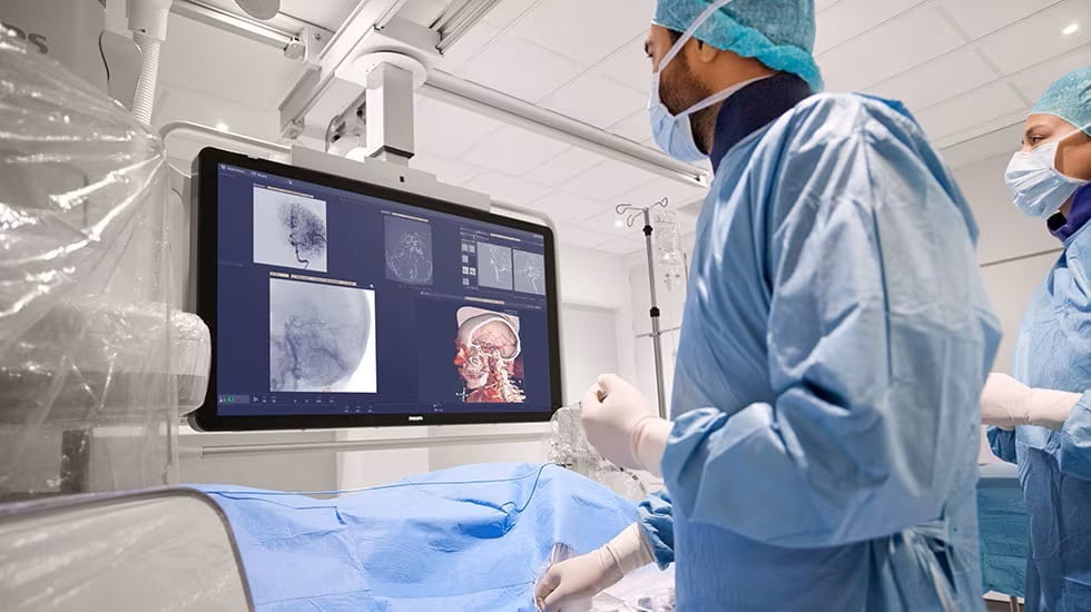 3D Behandlungsplanung am Azurion Katheterarbeitsplatz für minimalinvasive Eingriffe an Herz und Gefäßen 