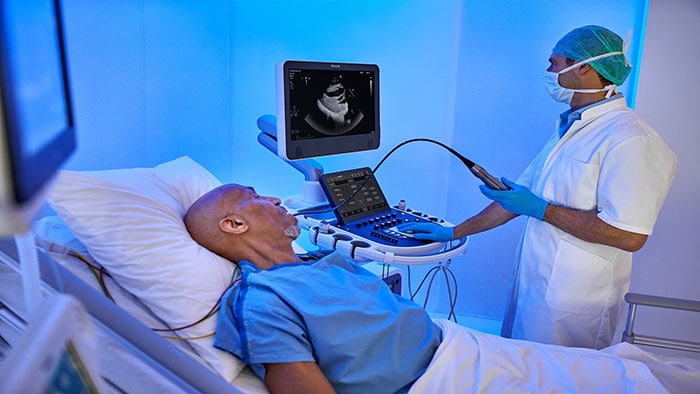Philips Ultraschallplattform mit verschiedenen KI-Tools zur Verbesserung der kardiovaskulären Bildgebung, Automatisierung und Produktivitätssteigerung
